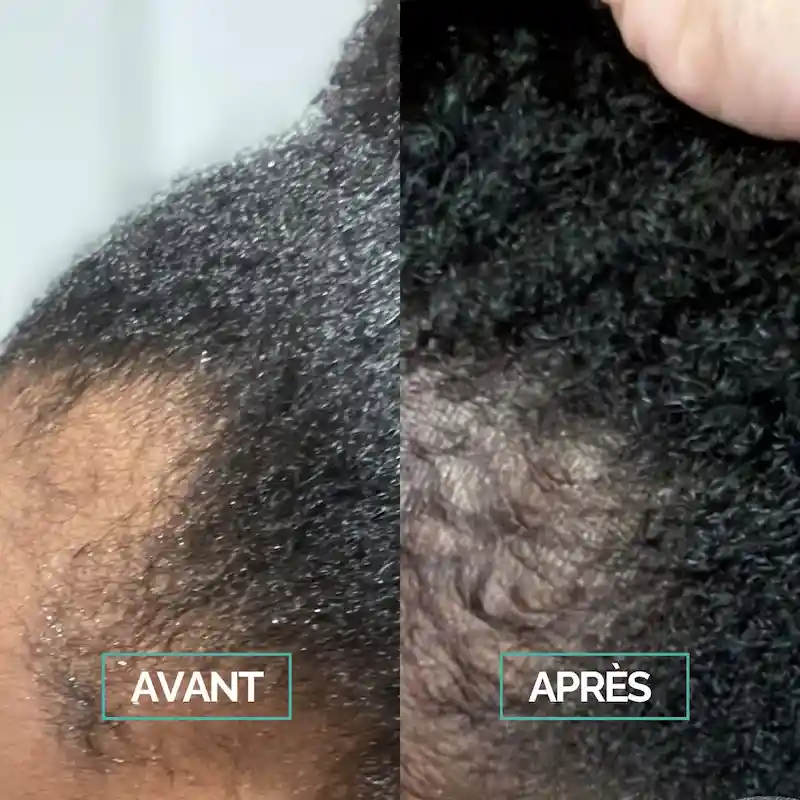 DUO Pousse & Soin Cuir Chevelu - In Haircare
