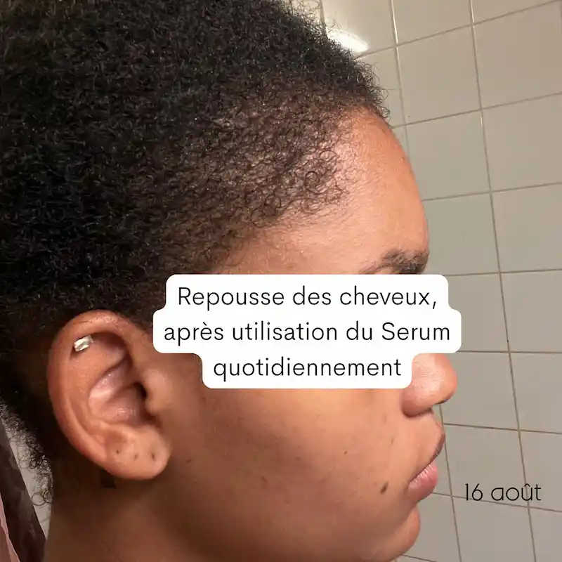 Sérum Anti-Chute Densifiant Grow & Glow - Chebhair