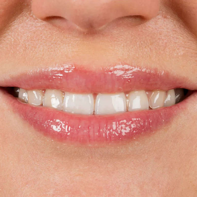 Gloss à Lèvres Booster d'Hydratation
