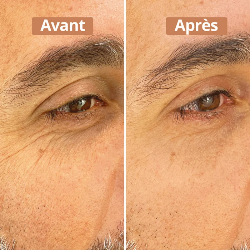 Sérum Contour des Yeux