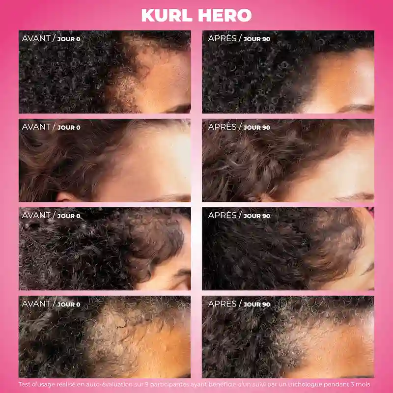 Kurl Hero Sérum Anti-chute - Les Secrets de Loly