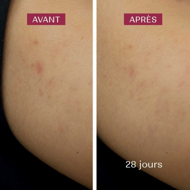 Crème de Nuit Anti-taches