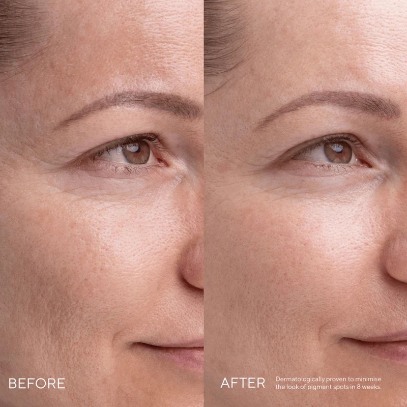 KOJIC ALTERNATIVE - Sérum Pigmentaire