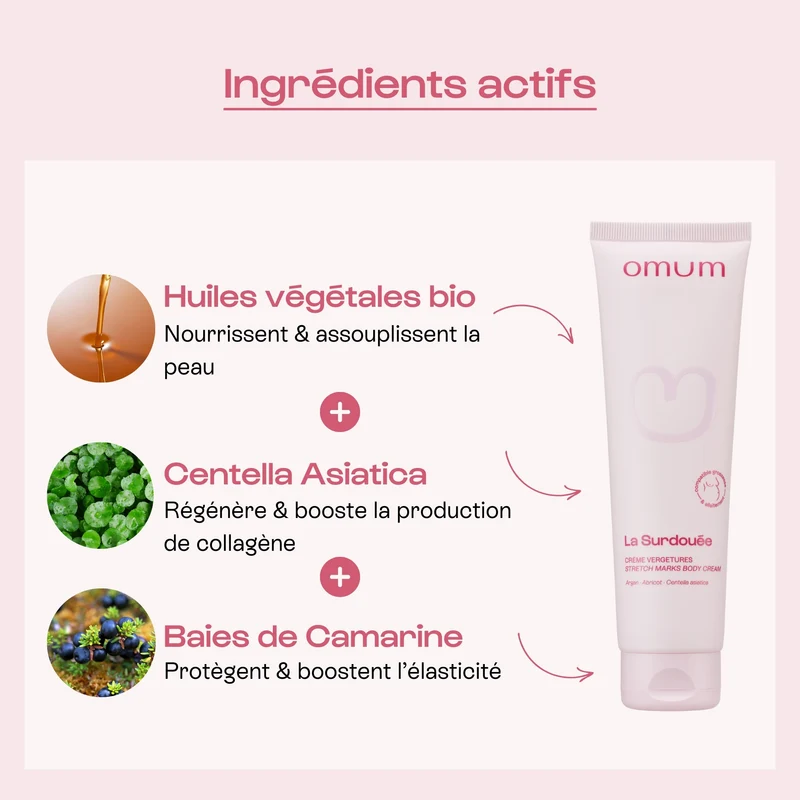 Crème Anti-Vergetures | La Surdouée