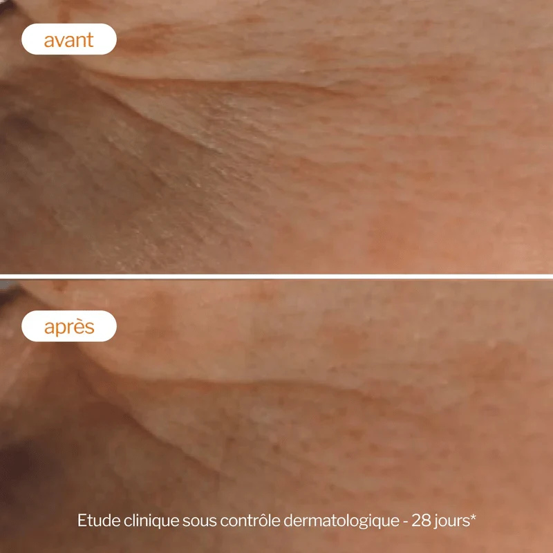 Soin Peeling Eclat