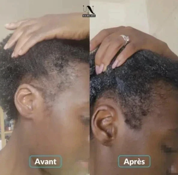 Gummies Pousse Cheveux Cure 3 mois - In Haircare