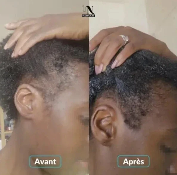 Gélules Pousse Cheveux Cure 3 mois - In Haircare