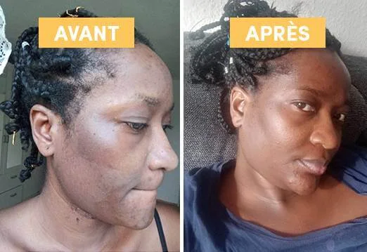 Macérat Huileux de Busserole - WAAM