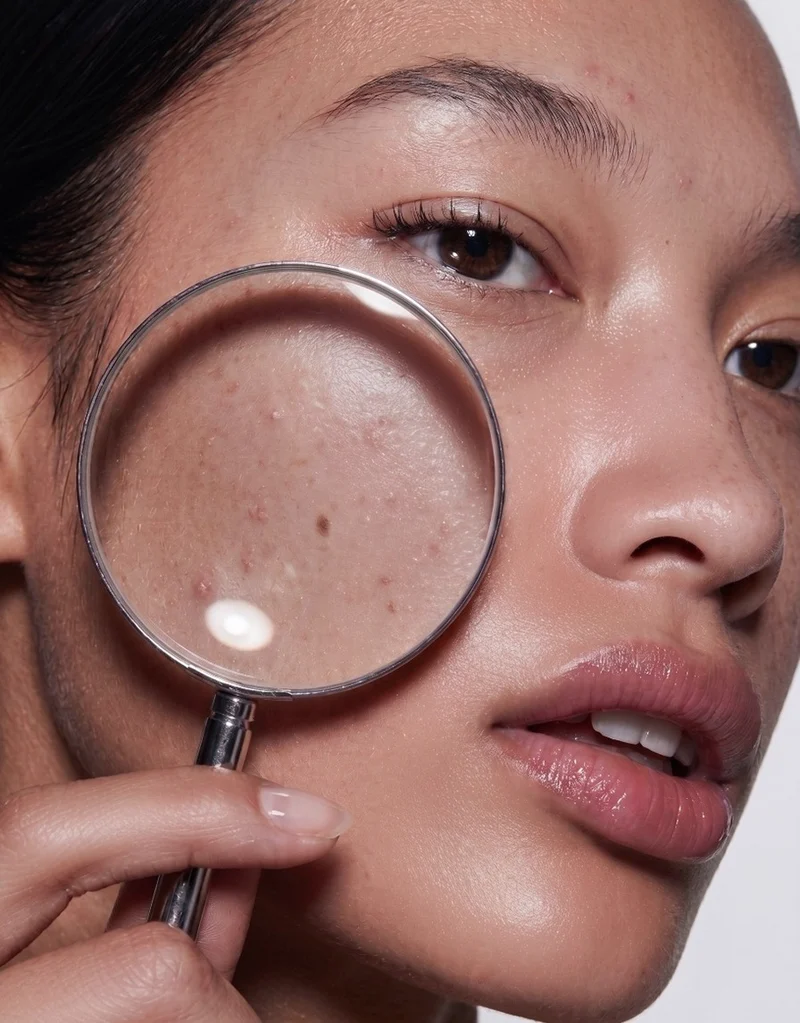 Anti-Imperfection Routine