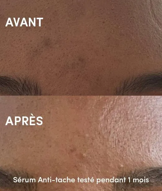 Sérum Anti-tache à l'Extrait de Busserole