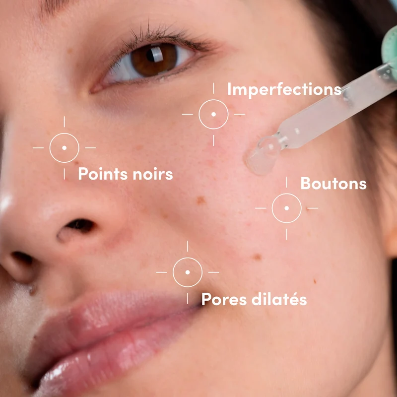 Routine Anti-Imperfections