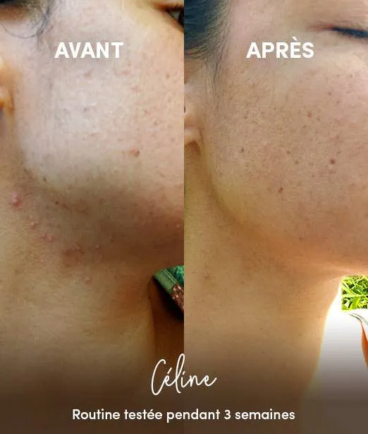Masque Visage Purifiant en Poudre