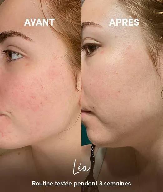 Masque Visage Purifiant en Poudre