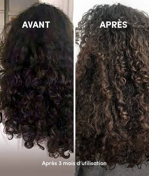 Complément Alimentaire Cheveux